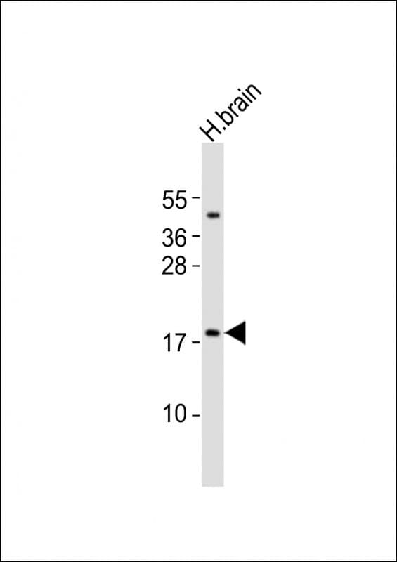 CALY Antibody (aa60-94)