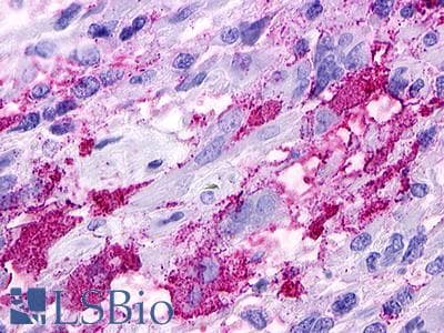 PathPlus™ GPR52 Antibody (Cytoplasmic Domain)