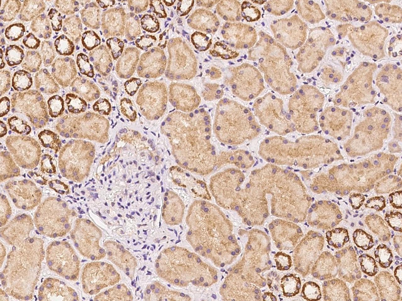 Polyclonal Rabbit anti-Human C17orf99 Antibody (IHC)