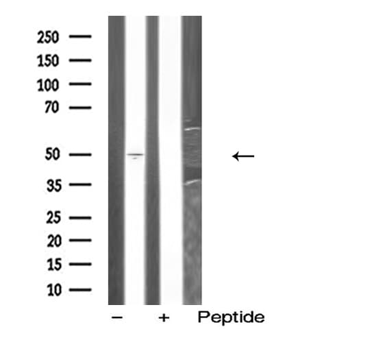 OX1R / Orexin Receptor 1 Antibody