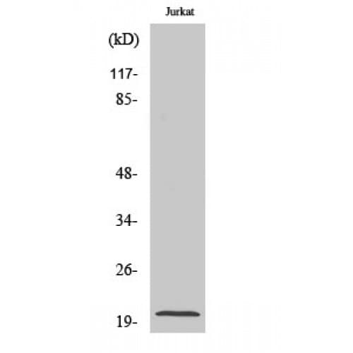 RGS10 Antibody (50-130 aa, Internal)