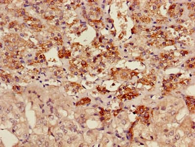 AKAP7 Antibody