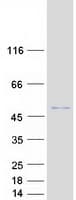 Human PDEF / SPDEF Protein (Recombinant Myc-DDK (Flag))