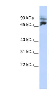 Polyclonal Rabbit anti-Human KIF2A Antibody (aa72-121, IHC, WB)