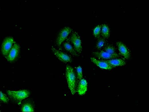 TNNI1 Antibody