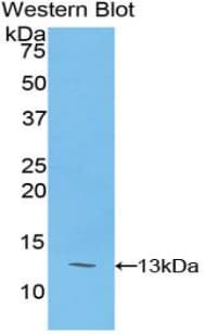 PIGR Antibody (aa353-457)