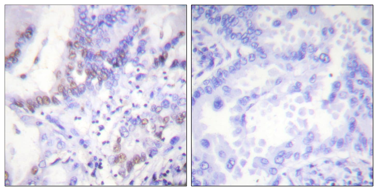 ABL1 / c-ABL Antibody (phospho-Tyr412)