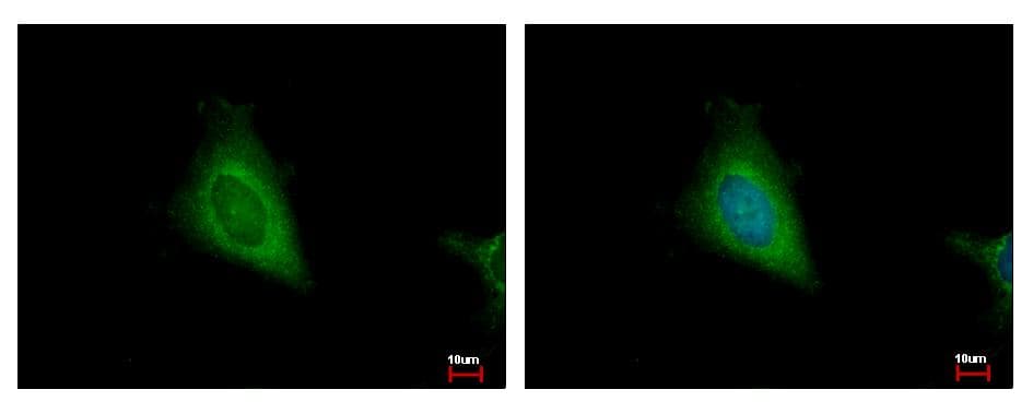 HSD17B4 Antibody (aa18-261)