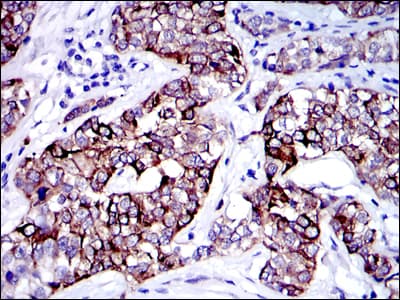 KRT19 / CK19 / Cytokeratin 19 Antibody (clone 4E8)