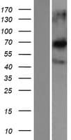 CCDC120 Protein (Over-Expression Lysate Myc-DDK (Flag))