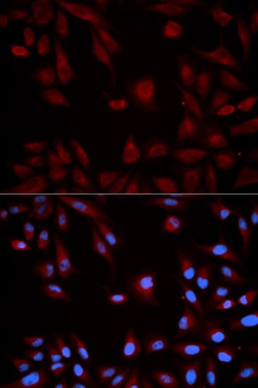 STAT5B Antibody