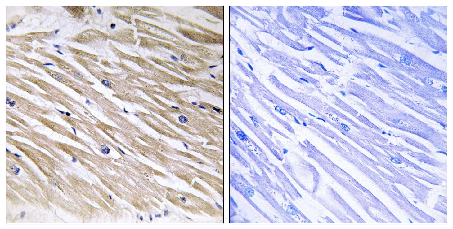 PEA15 / PEA-15 Antibody (Ab-104)