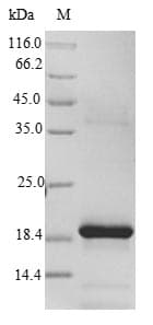 FXN / Frataxin Protein (Recombinant)