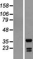 ING5 Protein (Over-Expression Lysate Myc-DDK (Flag))