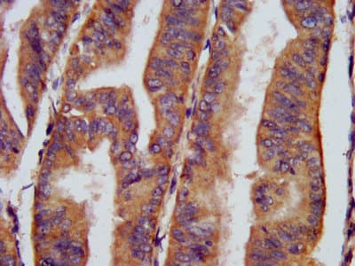 CHRNB3 Antibody