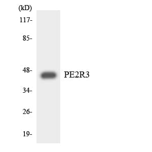 Polyclonal Rabbit anti-Human PTGER3 / EP3 Antibody (aa39-88, IHC, WB)