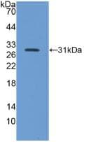 ITGB5 / Integrin Beta 5 Antibody (aa136-378, Cy3)
