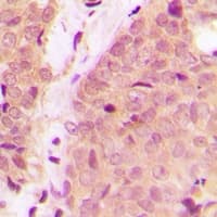 CHUK/IKBKB Antibody (Internal)