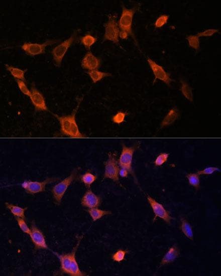 Polyclonal Rabbit anti-Human UFC1 Antibody (IF)