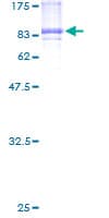 Human CAP2 Protein (Recombinant GST)