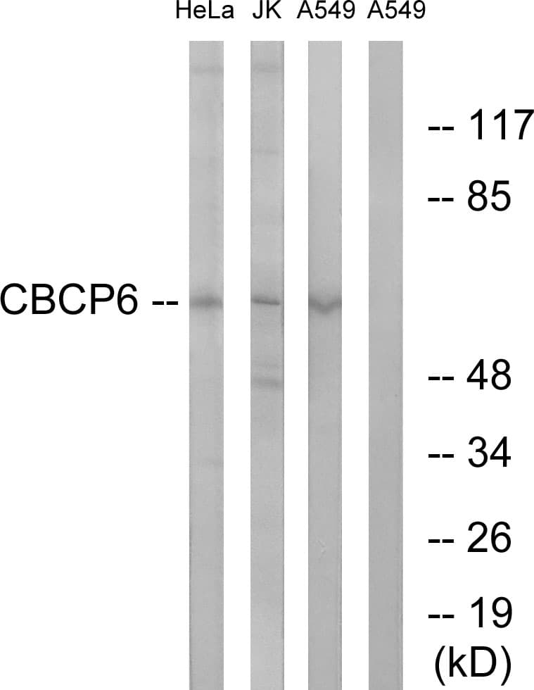 AGBL4 Antibody (aa431-480)