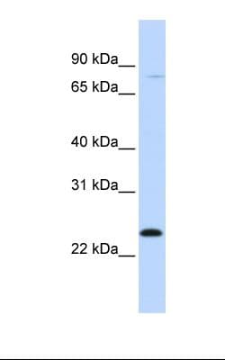MX1 / MX Antibody (C-Terminus)