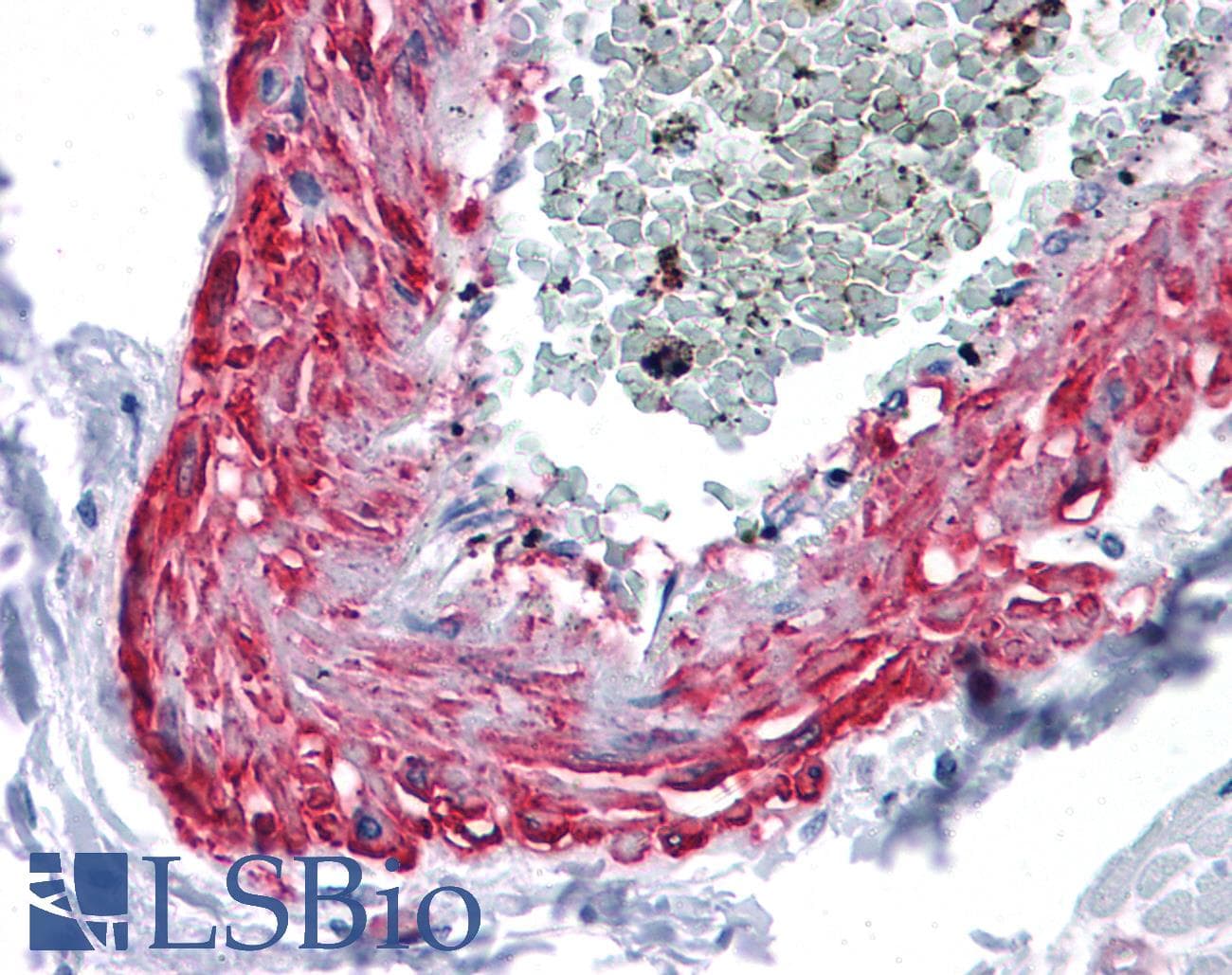 IHC-plus™ Monoclonal Mouse anti-Human MYOC / Myocilin Antibody (clone 4F8, IHC, WB)