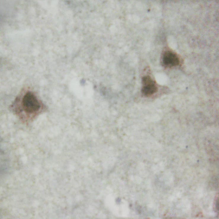 Polyclonal Rabbit anti-Human CHEK1 / CHK1 Antibody (phospho-Ser296, IHC, IF, WB)