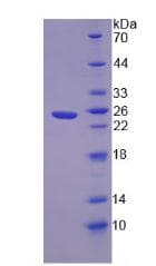 Human NOVA1 Protein (Recombinant His-T7, N-terminus)