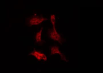 EZR / Ezrin Antibody (phospho-Tyr146)