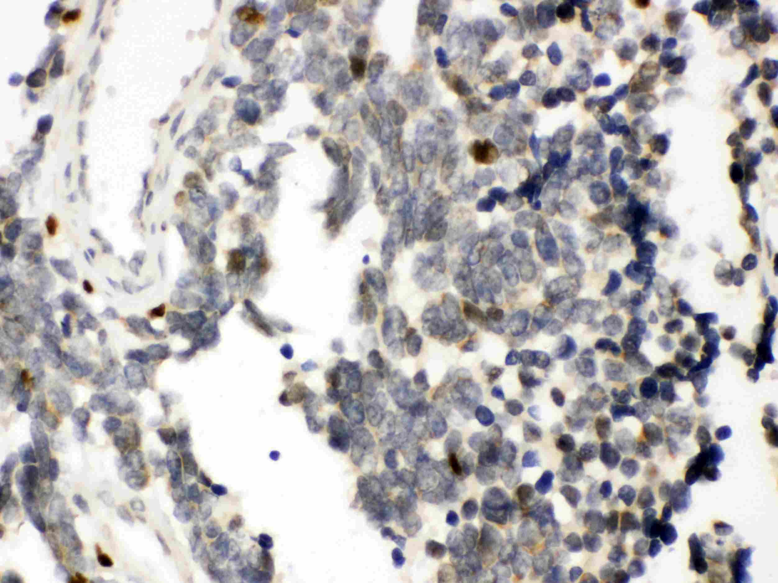 Polyclonal Rabbit anti-Human RUNX3 Antibody (IHC, WB)