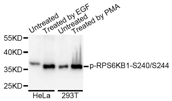RPS6 / Ribosomal Protein S6 Antibody (phospho-Ser240/244)