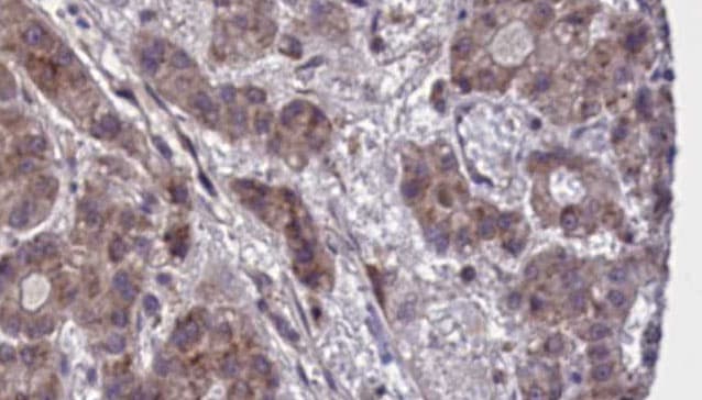 Polyclonal Rabbit anti-Human GPR55 Antibody (IHC, WB)
