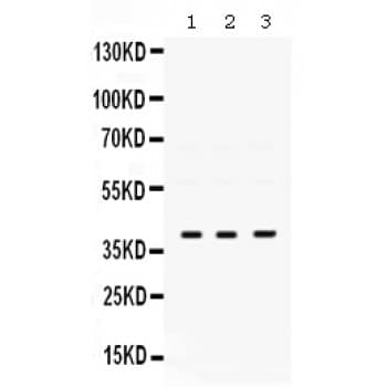 POLB / DNA Polymerase Beta Antibody (aa122-335)