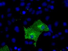 TLDC1 / KIAA1609 Antibody (clone OTI7E4)