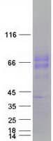 Human CD39 Protein (Recombinant Myc-DDK (Flag))