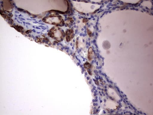 KRT19 / CK19 / Cytokeratin 19 Antibody (aa240-390, clone OTI7H7)