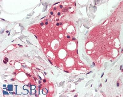IHC-plus™ LP-PLA2 / PLA2G7 Antibody