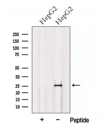 Polyclonal Rabbit anti-Human HOXB7 Antibody (WB)
