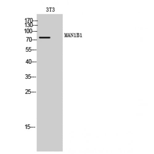 MAN1B1 Antibody (100-180 aa, Internal)