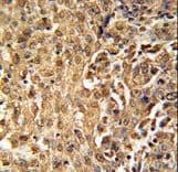 PARP13 / ZC3HAV1 Antibody (aa604-632)