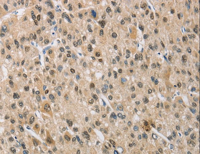 IHC-plus™ NAPSA / NAPA / Napsin A Antibody