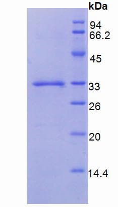 Human F3 / CD142 / Tissue factor Protein (Recombinant His)