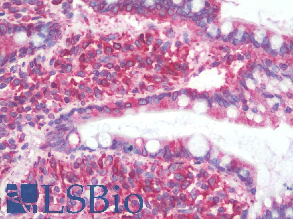 PathPlus™ Polyclonal Goat anti-Human CANX / Calnexin Antibody (C-Terminus, IHC, IF, WB)