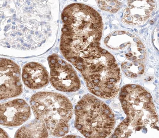 Polyclonal Rabbit anti-Human EIF4EBP1 / 4EBP1 Antibody (phospho-Thr45, IHC, IF, WB)