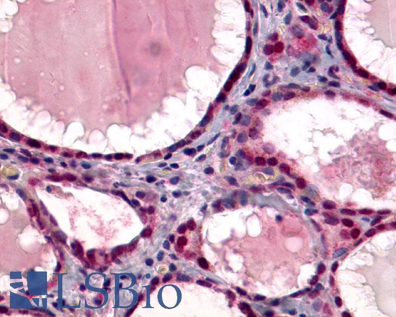 PathPlus™ Polyclonal Rabbit anti-Human TSH Receptor / TSHR Antibody (C-Terminus, IHC)