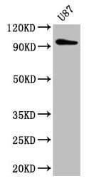 Polyclonal Rabbit anti-Human TTLL6 Antibody (IHC)