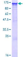 Human MGEA5 Protein (Recombinant GST)
