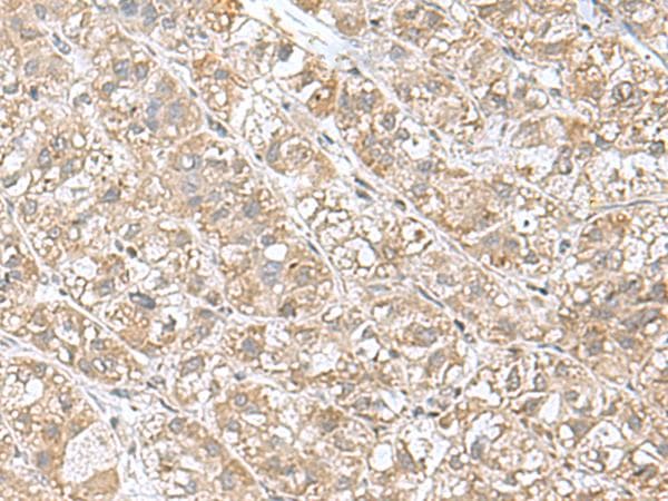 EIF1AY Antibody