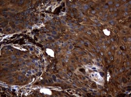 NME1 / NM23 Antibody (clone OTI1H4)